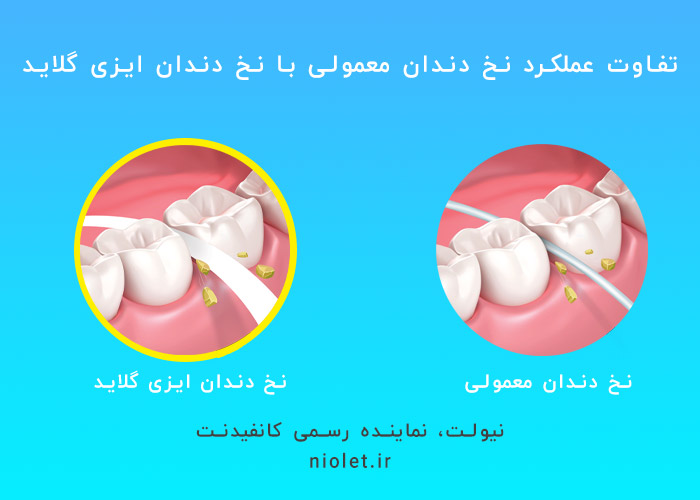 مقایسه انواع نخ دندان ایزی گلاید با نخ دندان معمولی